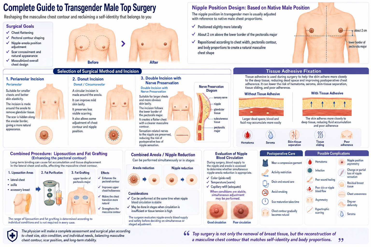 Comprehensive infographic guide to top surgery for transgender men, including goals, nipple position design, incision options, tissue adhesive fixation, combined liposuction and fat grafting, nipple-areolar reduction, postoperative care, and possible complications.